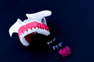 Tooth implant and crown installation process photo