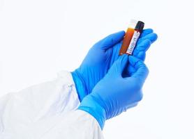 Coronavirus, Doctor holding positive covid-19 virus Blood Sample tube white background photo