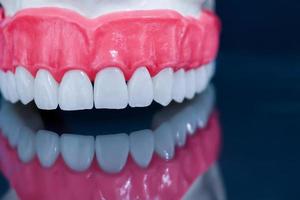 Upper human jaw model with a reflection on the glass photo