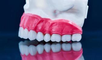 Upper human jaw model with a reflection on the glass photo