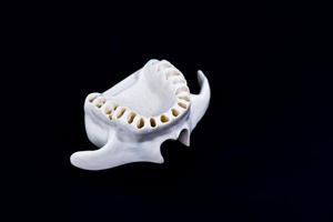 Mandíbula superior humana con dientes aislado sobre fondo negro foto