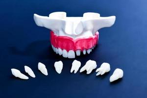 Tooth implant and crown installation process photo