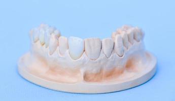 Gypsum model of human jaw photo