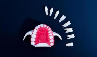 proceso de instalación de implantes dentales y coronas foto