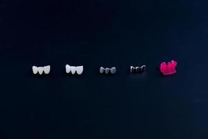 different types of dental tooth crowns photo