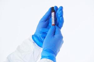 Coronavirus, Doctor holding positive covid-19 virus Blood Sample tube white background photo