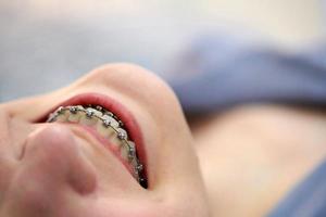 Smiling girl with braces close up. photo