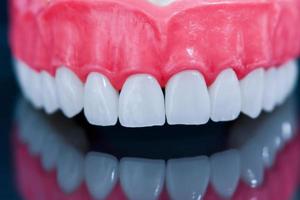 Upper human jaw model with a reflection on the glass photo