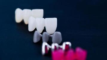 different types of dental tooth crowns photo