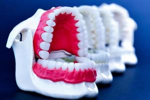 Dentist orthodontic teeth models photo