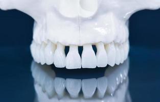 Upper human jaw model with a reflection on the glass photo