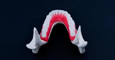 Lower human jaw with teeth and gums anatomy model photo