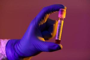 Coronavirus, Doctor holding positive covid-19 virus Blood Sample test tube photo