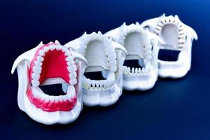 Dentist orthodontic teeth models photo