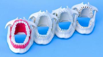 Modelos de dientes de ortodoncia dentista foto
