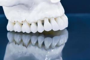 Upper human jaw model with a reflection on the glass photo
