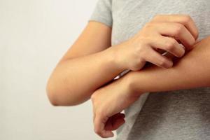 Health problems, woman has itchy hands photo