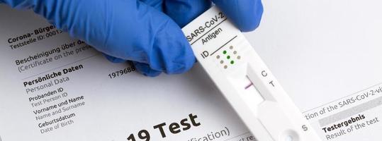 Negative test result by using rapid test device for COVID-19. photo