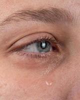 eye with a tear flowing down a woman cheek photo