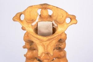 Artificial human cervical spine model photo