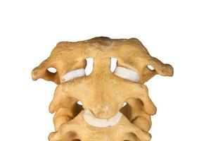 Artificial human cervical spine photo