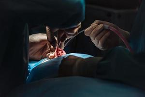 cirugía estética en la nariz. el cirujano corta la carne foto