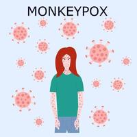 ilustración del virus del vector del brote de viruela del mono. infografía de viruela del mono en la ilustración plana del paciente