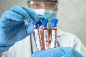 Positive blood infection sample in test tube for covid-19 coronavirus in lab. Scientist holding to check and analyze for patient in hospital. photo