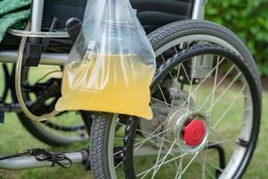 Asian lady woman patient sitting on wheelchair with urine bag in the hospital ward, healthy medical concept photo