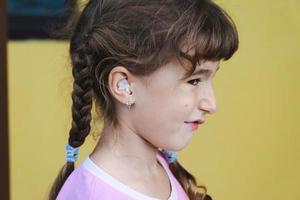 Girl with a warming therapeutic cotton swab in the ear with a sad and tearful face is holding her ear. Ear pain, otitis media, swelling of cheek, gums, toothache, children's surgery, otolaryngology photo