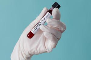 Hand holding testing patients blood samples for Coronavirus Outbreak COVID-19 in laboratory, New coronavirus 2019-nCoV from Wuhan China concept, Empty space isolated on blue background photo