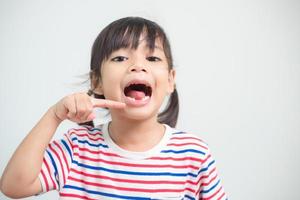 little Asian girl showing her broken milk teeth. photo