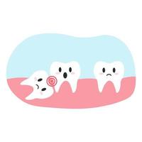 Impacted wisdom tooth in cartoon flat style. Vector illustration of disgruntled teeth characters, dental health concept, oral hygiene