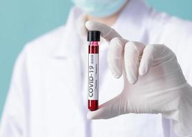 Nurse holding testing patients blood samples for Coronavirus Outbreak COVID-19 in the laboratory, New coronavirus 2019-nCoV from Wuhan China concept photo