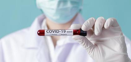 enfermera con máscara de respirador para detener el brote de coronavirus covid-19 y sosteniendo muestras de sangre de pacientes para el virus de la corona de wuhan china en laboratorio, espacio vacío aislado en una pancarta larga foto