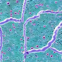 bacterias y virus en la superficie de la piel, membrana mucosa o intestino, modelo de mers, vih, gripe, escherichia coli, salmonella, klebsiella, legionella, mycobacterium tuberculosis, modelo de microbios foto