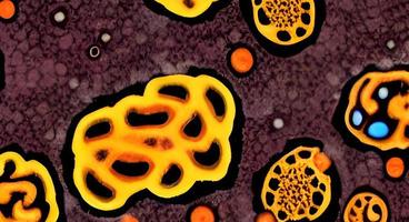 Bacteria and viruses on surface of skin, mucous membrane or intestine, model of MERS, HIV, flu, Escherichia coli, Salmonella, Klebsiella, Legionella, Mycobacterium tuberculosis, model of microbes photo