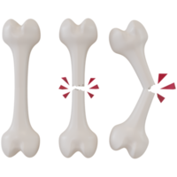 renderização 3D de ossos quebrados em diferentes estágios png