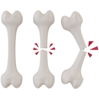 3d rendering of broken bones in different stages png