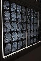 imágenes de resonancia magnética del cerebro humano foto