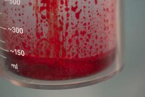 Blood loss in container in operating room photo