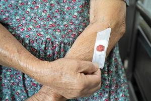 Asian senior or elderly old lady woman patient show cotton wool stop bleeding, after blood drawing testing for annually physical health check up to check cholesterol, blood pressure, and sugar level. photo