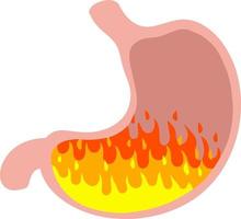 Digestive problems. Heartburn in stomach. Medical care. Indigestion in belly. Fire and internal organ of man. Symbol of Spicy food and pepper. Cartoon flat illustration vector