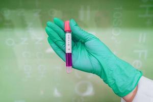 A rubber-gloved hand holds one test tube with coronavirus photo