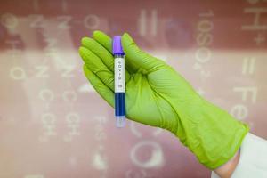 A rubber-gloved hand holds one test tube with coronavirus photo