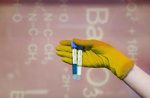 A rubber-gloved hand holds two test tube with coronavirus photo