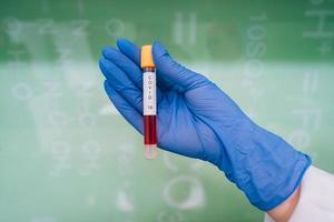 A rubber-gloved hand holds one test tube with coronavirus photo