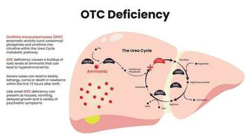 Ornithine Transcarbamylase OTC Deficiency diagram vector