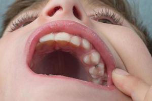 Jaw with children's straight teeth close-up. photo