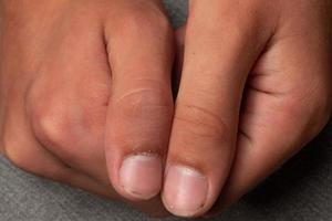 Dirty and long nails with burrs, fingers and fingernails of a child on a gray background. photo